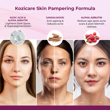 Kozicare Kojic Acid Cream | Real Sandalwood Cream | Moisturizer For Dry Skin | Detan Cream | Tan Removal Cream | Face Cream For Summer Daily Use| Face Cream For Women & Men - 15gm