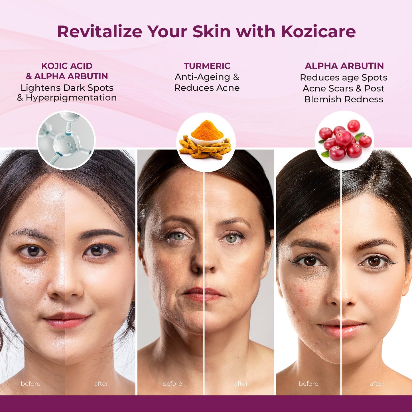 Kozicare Kojic Acid Cream | Skin Whitening Cream | Turmeric Cream | Glutathione Cream | Detan Cream | Moisturizer for Dry Skin | Face Cream for Summer Daily Use | Face Cream for Women & Men - 15gm